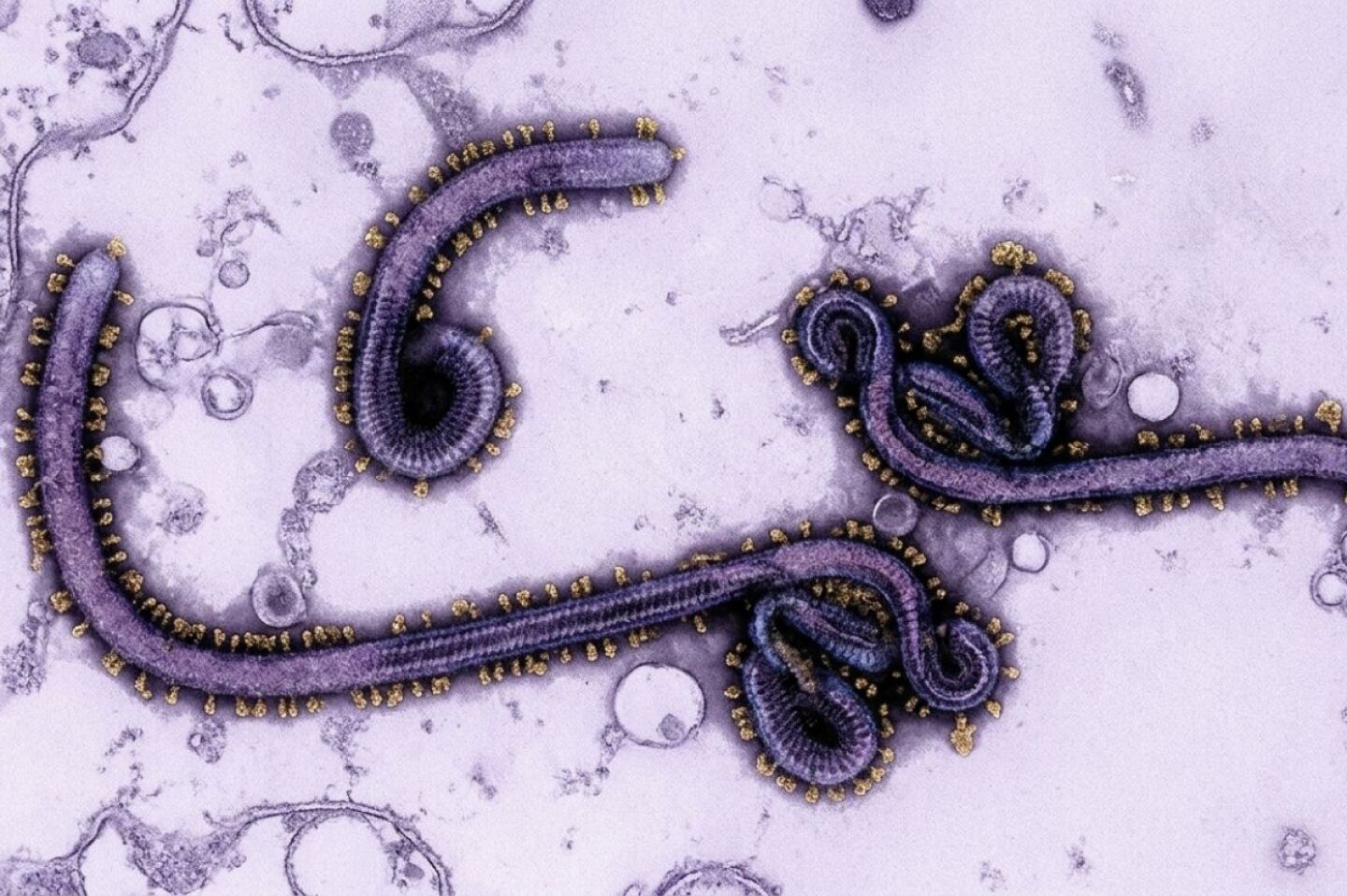 Ébola: así se contagia el virus que preocupa a la OMS